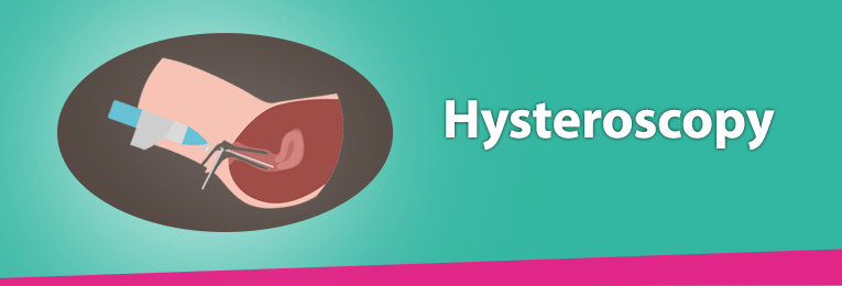 Hysteroscopy Doctor in Greater Noida